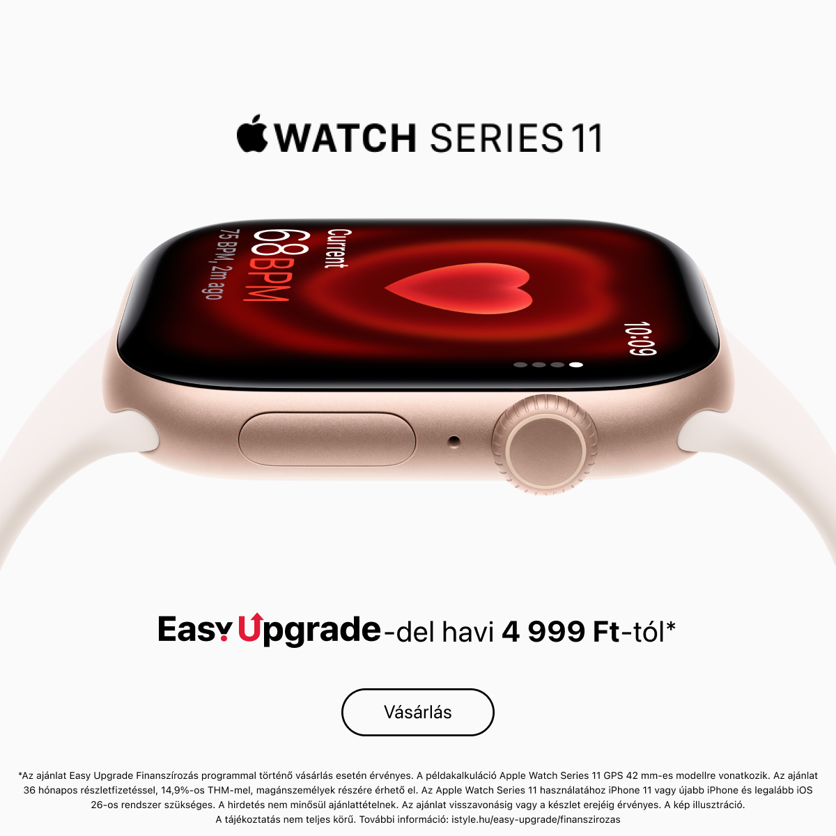 Apple Watch Series 11