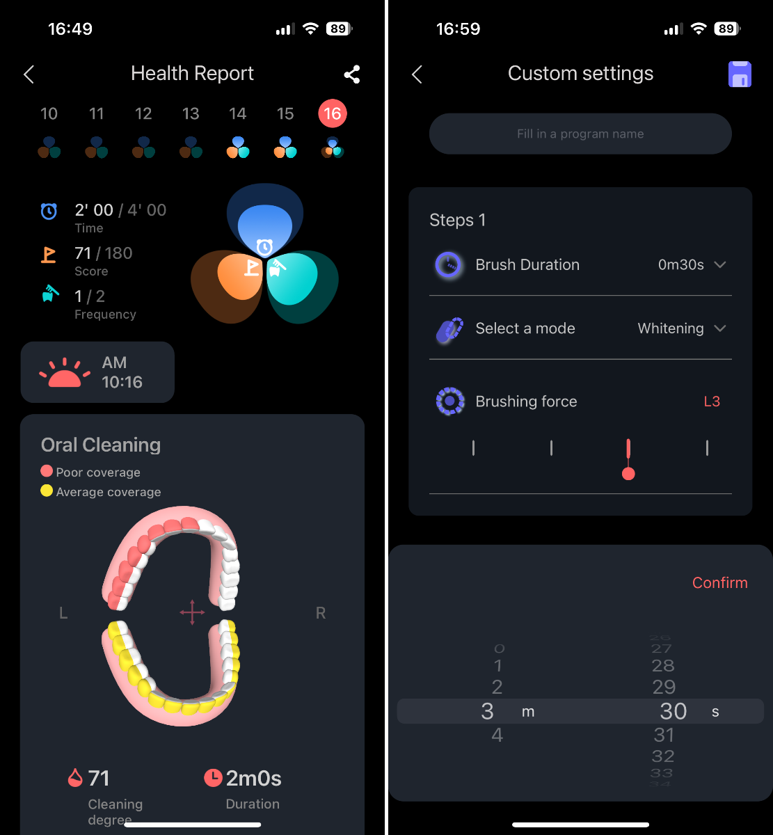 Oclean X Ultra S mobilapp