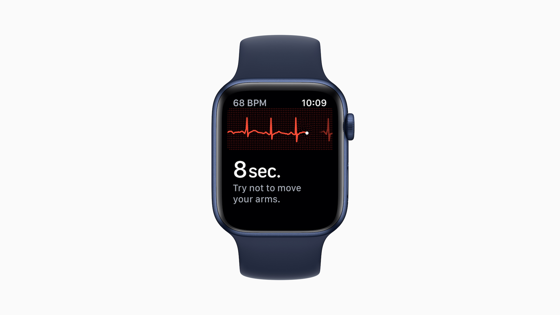 Pitvarfibrilláció felismerése okosórával Pitvarfibrilláció felismerése okosórával