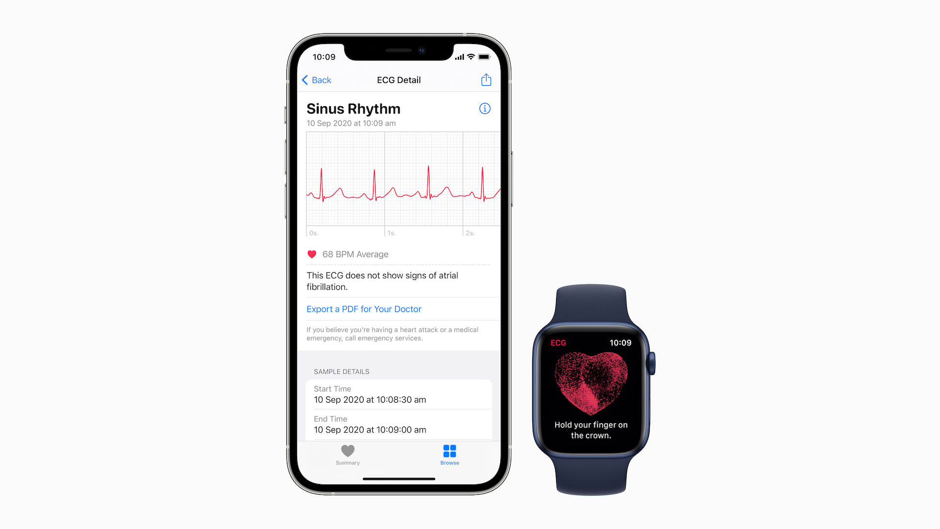 EKG mérés Apple eszközökkel EKG mérés Apple eszközökkel